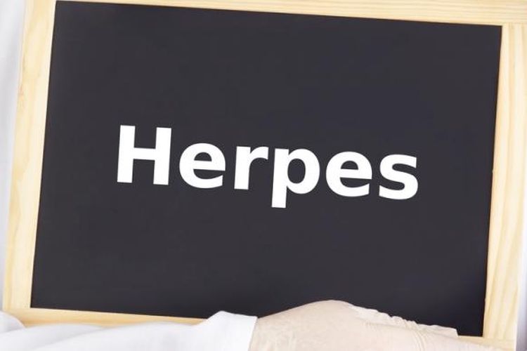 Ilustrasi penyakit herpes(Shutterstock)